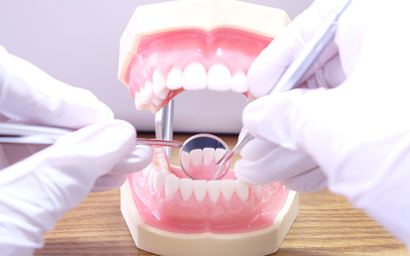 歯周病の治療方法や原因とは？ 気が付かないまま放置するリスク