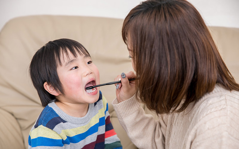 子供の虫歯予防は親の務め！ 将来への影響や予防策を紹介