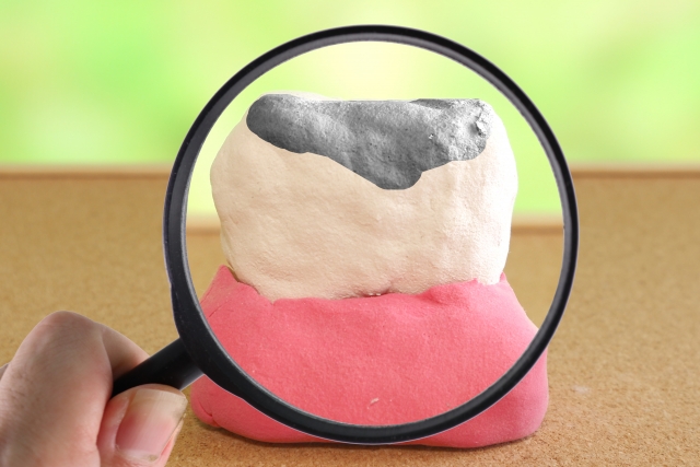 虫歯のイラスト