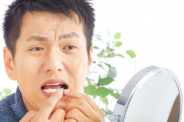 虫歯になる原因とは？ 3つの原因を知って虫歯予防に努めよう