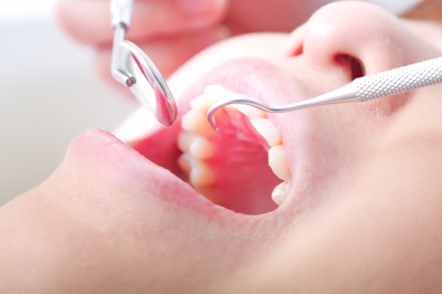 歯科治療を受ける人の口元