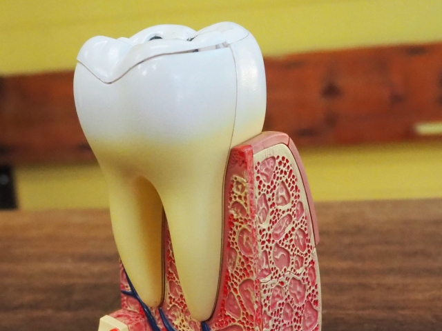 歯周ポケット内の歯石は除去必須！ 正しいケアと代表的予防策を紹介